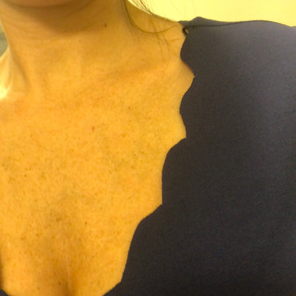 Short dress - Picture 4 of 7